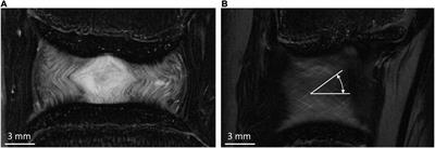 Sensitivity of Intervertebral Disc Finite Element Models to Internal Geometric and Non-geometric Parameters